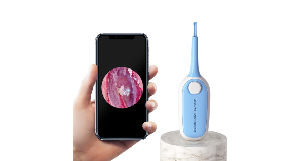 Smart Luminous Earwax Removal Ear Cleaning Tool Wireless WiFi Ear Pick ...